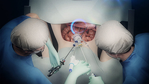 3D CGI surgery laproscopic olympus triport asc 03